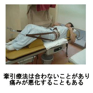 CXg04