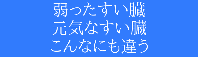 oꐶ